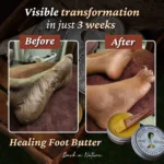 healing-foot
