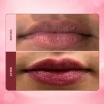 lipbalm