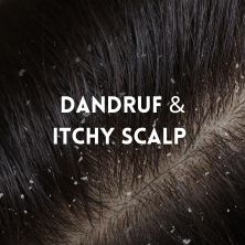 Dandruff & Itchy Scalp