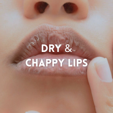 Dry And Cracky Lips