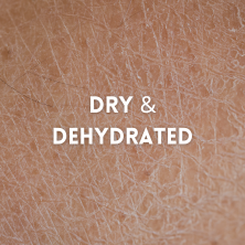 Dry &. Dehydrated Skin