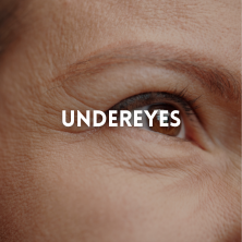 Under Eyes